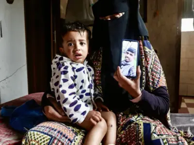 ޣައްޒާގެ ދެ މަހުގެ ތުއްތު ކުއްޖެއްގެ ގައިގައި ސަހްޔޫނީން ސިގަރެޓުން ޖައްސާ އަނިޔާކޮށްފި